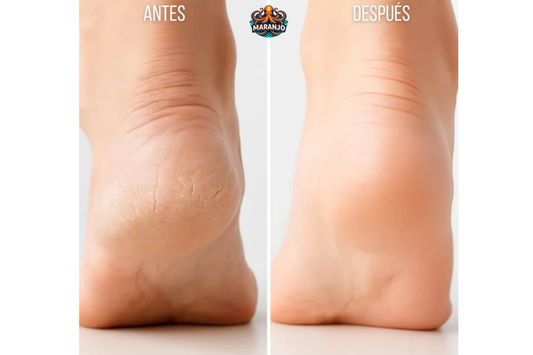 REMOVEDOR CALLOS ELECTRICO RECARGABLE USB/Kit de pedicura en casa para pies lisos (hombres y mujeres)